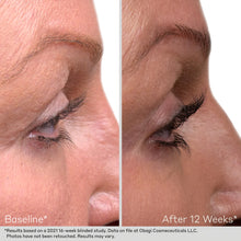 Load image into Gallery viewer, Obagi Nu-Cil Eyelash Serum