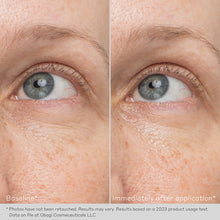 Load image into Gallery viewer, Obagi Hydro Drops Rejuvenating Eye Gel Cream