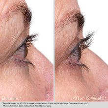 Load image into Gallery viewer, Obagi Nu-Cil Eyelash Serum