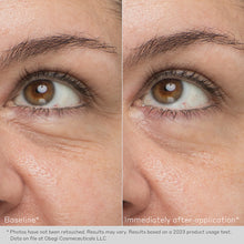 Load image into Gallery viewer, Obagi Hydro Drops Rejuvenating Eye Gel Cream
